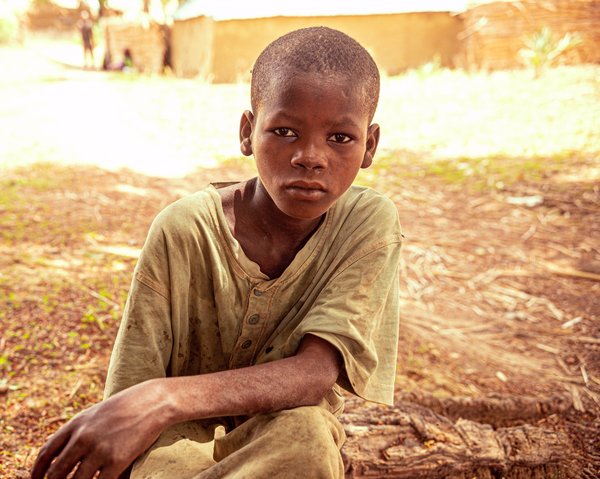 Nasiru is unable to finish his leprosy treatment because of supply chain issues in Nigeria.JPG