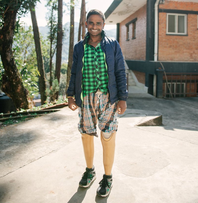 Santosh can walk again thanks to prosthetic legs provided by Anandaban Hospital.